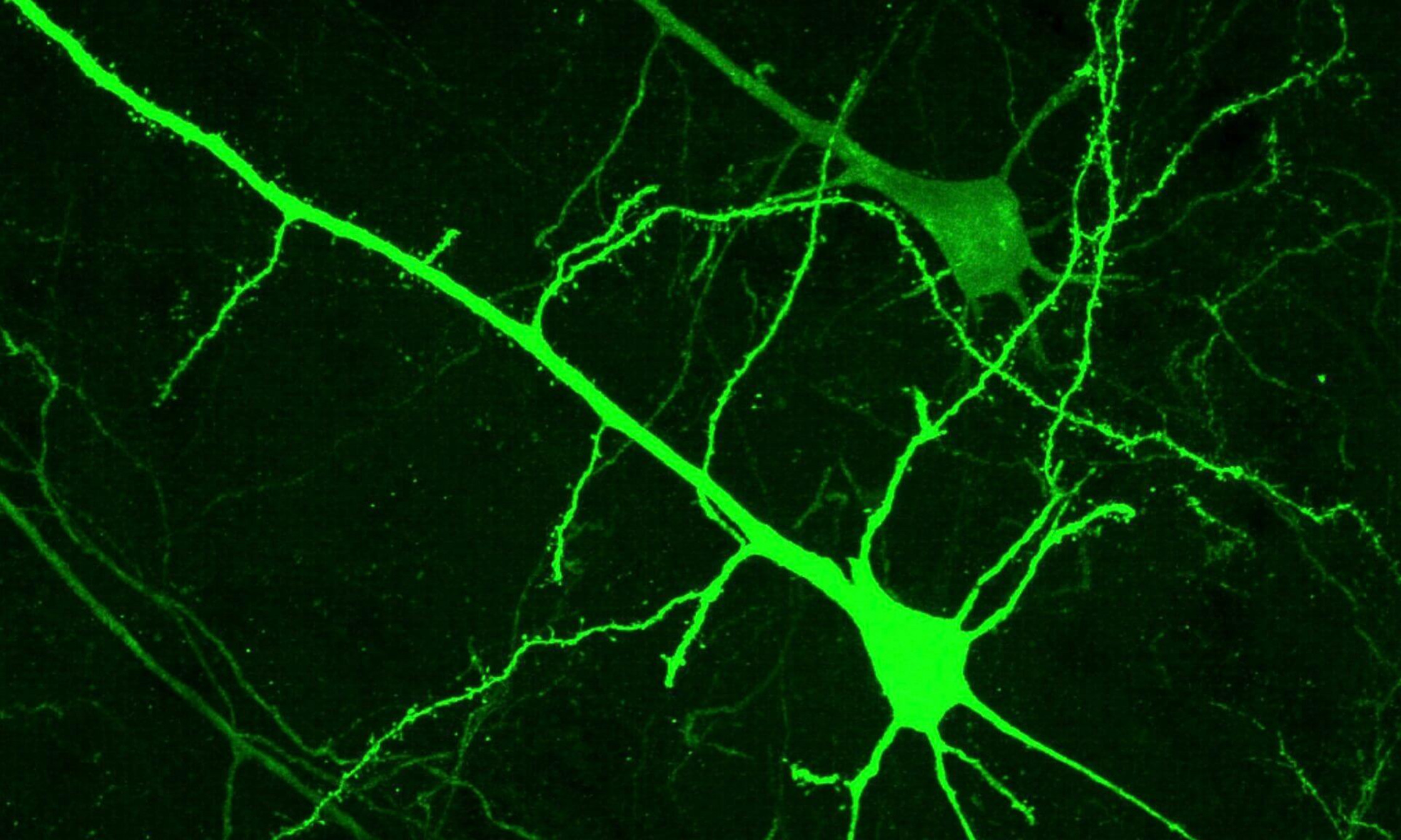 Neurone du cerveau d'une souris ayant participé à l'étude.