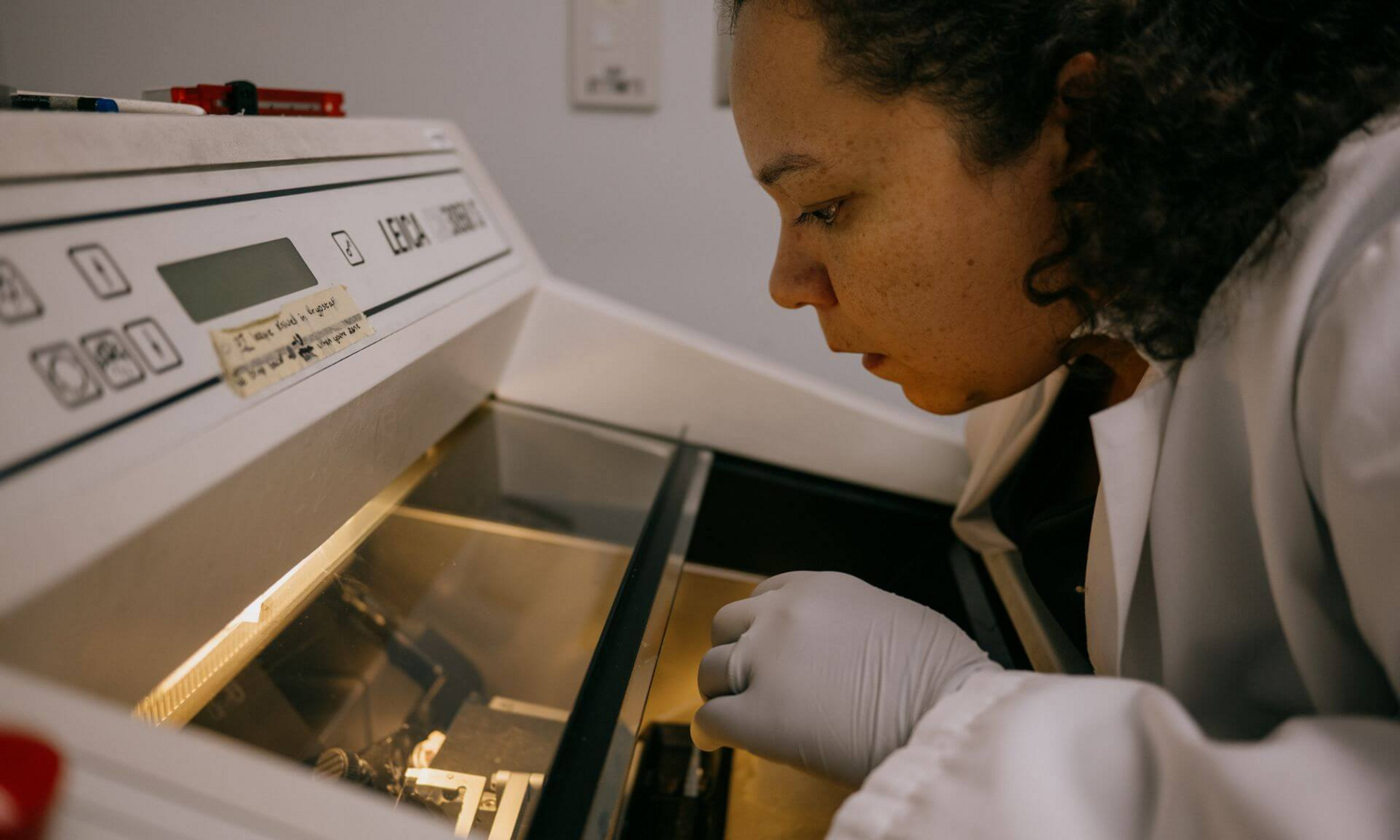 As a specialist in amyotrophic lateral sclerosis (ALS), Alicia Dubinski has focused her research on the role of stress granules and TDP-43 pathology in the progressive death of motor neurons.