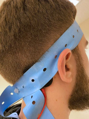 What set this study apart was the use of galvanic vestibular stimulation, a technique that delivers low-level electrical currents to the mastoids to artificially stimulate the vestibular system and induce a swaying sensation.